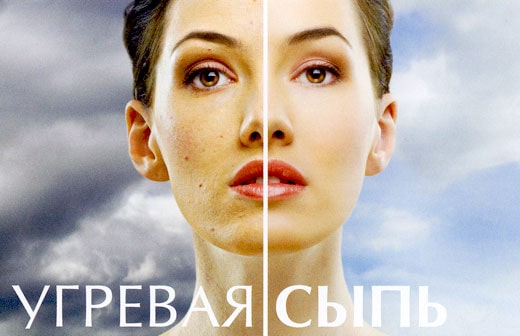 Акне зображення