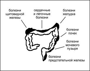 Порушення в товстій кишці при різних захворюваннях